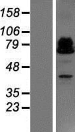 Novus Biologicals™ ZBTB46 Overexpression Lysate