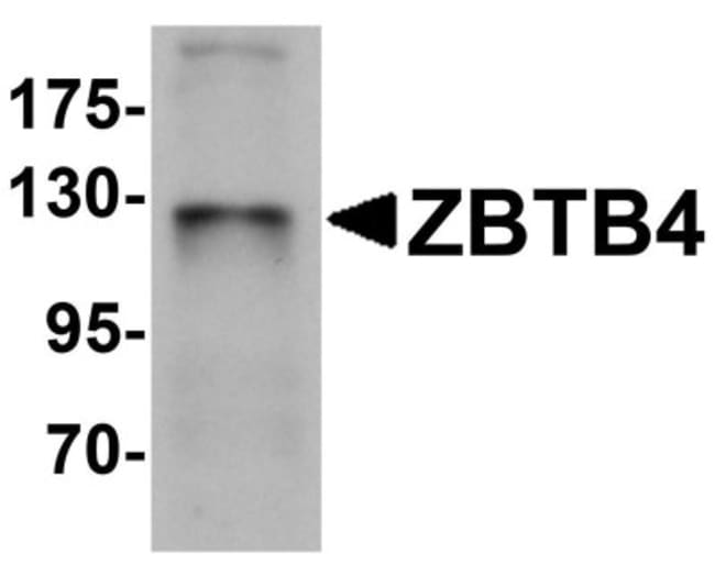 ZBTB4 - 0.1 MG