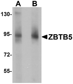 ZBTB5 Antibody - BSA Free, Novus Biologicals 0.025 mg, Unconjugated:Antibodies,