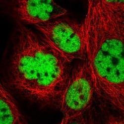 ZBTB7A/Pokemon Antibody, Novus Biologicals 25 &mu;L | Buy Online | Novus Biologicals | Fisher Scientific