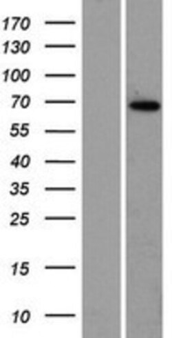 Novus Biologicals™ ZBTB7C Overexpression Lysate