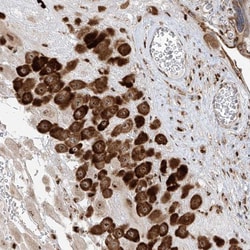ZBTB8A Antibody, Novus Biologicals:Antibodies:Primary Antibodies