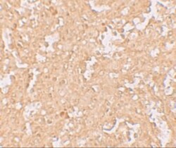 ZBTB8A Antibody - BSA Free, Novus Biologicals 0.025 mg, Unconjugated:Antibodies,