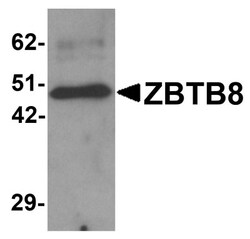 ZBTB8A Antibody - BSA Free, Novus Biologicals 0.025 mg, Unconjugated:Antibodies,