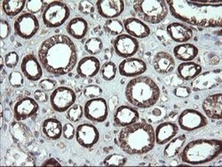 CGI 62 Antibody (OTI4C1), Novus Biologicals 0.1mL; Unlabeled:Antibodies,