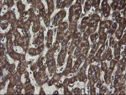 CGI 62 Antibody (OTI4C1), Novus Biologicals 0.1mL; Unlabeled:Antibodies,