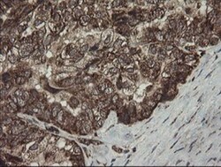 CGI 62 Antibody (OTI4C1), Novus Biologicals 0.1mL; Unlabeled:Antibodies,