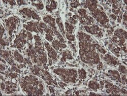 CGI 62 Antibody (OTI4C1), Novus Biologicals 0.1mL; Unlabeled:Antibodies,