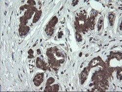 CGI 62 Antibody (OTI4C1), Novus Biologicals 0.1mL; Unlabeled:Antibodies,