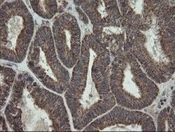 CGI 62 Antibody (OTI4C1), Novus Biologicals 0.1mL; Unlabeled:Antibodies,