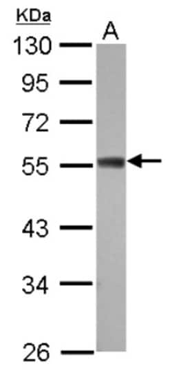 ZC3H10 Antibody, Novus Biologicals 0.1mL; Unlabeled:Antibodies, Polyclonal