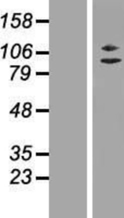 Novus Biologicals™ ZC3H11A Overexpression Lysate