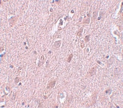 ZC3H12B Antibody - BSA Free, Novus Biologicals 0.1mg; Unlabeled:Antibodies,