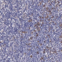 ZC3H12B Antibody, Novus Biologicals:Antibodies:Primary Antibodies