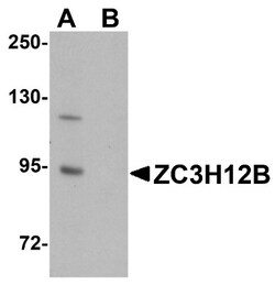 ZC3H12B Antibody - BSA Free, Novus Biologicals 0.1mg; Unlabeled:Antibodies,