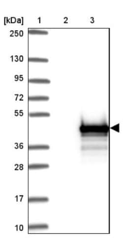 ZC3H12D Antibody, Novus Biologicals 0.1mL; Unlabeled:Antibodies, Polyclonal