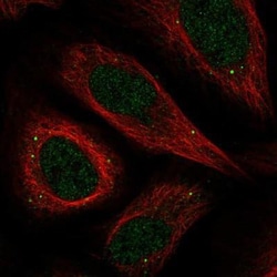 ZC3H12D Antibody, Novus Biologicals 0.1mL; Unlabeled:Antibodies, Polyclonal