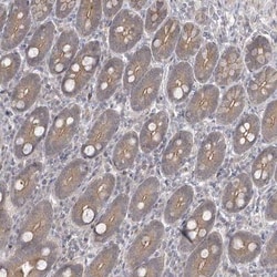 ZC3H12D Antibody, Novus Biologicals 0.1mL; Unlabeled:Antibodies, Polyclonal