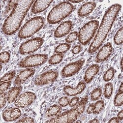 ZC3H14 Antibody, Novus Biologicals 0.1mL; Unlabeled:Antibodies, Polyclonal