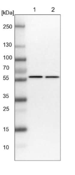 ZC3H15 Antibody, Novus Biologicals 25 &mu;L; Unlabeled:Antibodies, Polyclonal