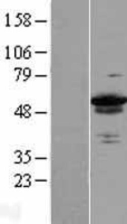 Novus Biologicals&trade;&nbsp;ZC3H15 Overexpression Lysate