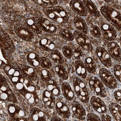 ZC3H15 Antibody, Novus Biologicals 0.1mL; Unlabeled:Antibodies, Polyclonal