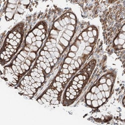ZC3H15 Antibody, Novus Biologicals 25 &mu;L; Unlabeled:Antibodies, Polyclonal