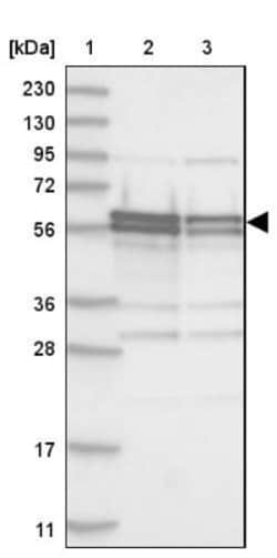 ZC3H15 Antibody, Novus Biologicals 0.1mL; Unlabeled:Antibodies, Polyclonal