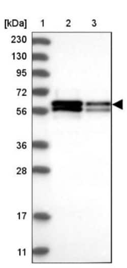 ZC3H15 Antibody, Novus Biologicals 25 &mu;L; Unlabeled:Antibodies, Polyclonal