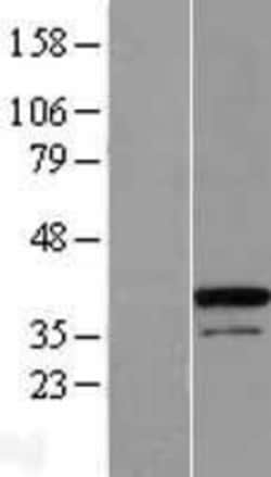 Novus Biologicals&trade;&nbsp;ZC3H8 Overexpression Lysate