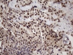 ZC3H8 Antibody (OTI4H5), Novus Biologicals 0.1mL; Unlabeled:Antibodies,