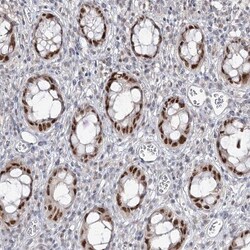 ZC3H8 Antibody, Novus Biologicals 25 &mu;L; Unlabeled:Antibodies, Polyclonal