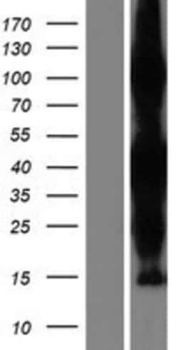 Novus Biologicals&trade;&nbsp;ZC3HAV1L Overexpression Lysate