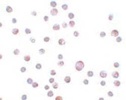 ZCCHV Antibody - BSA Free, Novus Biologicals 0.1mg; Unlabeled:Antibodies,