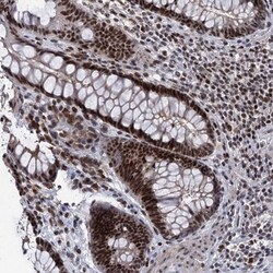 ZCCHC10 Antibody, Novus Biologicals:Antibodies:Primary Antibodies