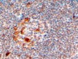 ZCCHC11/TUT4 Antibody, Novus Biologicals 0.1mg; Unlabeled:Antibodies, Polyclonal