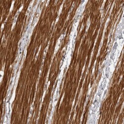 ZCCHC11/TUT4 Antibody, Novus Biologicals 0.1mL; Unlabeled:Antibodies, Polyclonal
