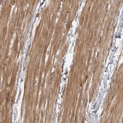 ZCCHC11/TUT4 Antibody, Novus Biologicals 25 &mu;L; Unlabeled:Antibodies,