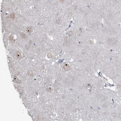 ZCCHC12 Antibody, Novus Biologicals 0.1mL; Unlabeled:Antibodies, Polyclonal