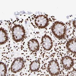 ZCCHC16 Antibody, Novus Biologicals 25 &mu;L | Buy Online | Novus Biologicals | Fisher Scientific