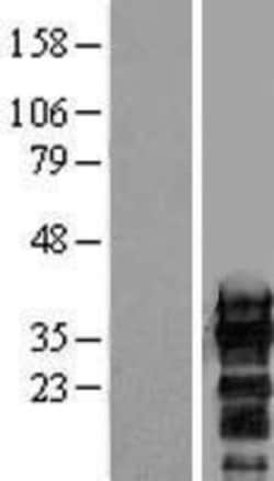 Novus Biologicals™ ZCCHC17 Overexpression Lysate