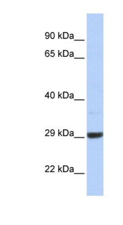 ZCCHC24 Antibody, Novus Biologicals:Antibodies:Primary Antibodies
