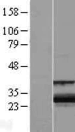 Novus Biologicals™ ZCCHC24 Overexpression Lysate