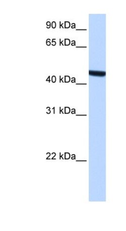 ZCCHC3 Antibody, Novus Biologicals 100&mu;L; Unlabeled:Antibodies, Polyclonal