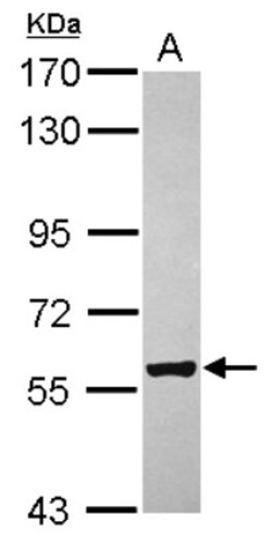 ZCCHC4 Antibody, Novus Biologicals 0.1mL; Unlabeled:Antibodies, Polyclonal