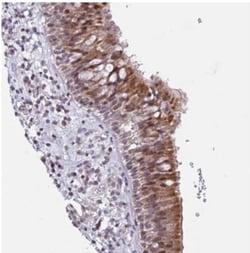 ZCCHC5 Antibody, Novus Biologicals 0.1mL; Unlabeled:Antibodies, Polyclonal