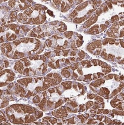 ZCCHC5 Antibody, Novus Biologicals:Antibodies:Primary Antibodies