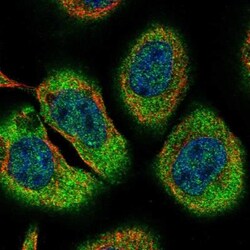 ZCCHC6 Antibody, Novus Biologicals:Antibodies:Primary Antibodies