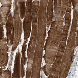 ZCCHC6 Antibody, Novus Biologicals:Antibodies:Primary Antibodies