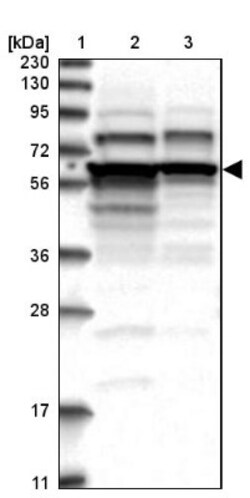 ZCCHC7 Antibody, Novus Biologicals 0.1mL; Unlabeled:Antibodies, Polyclonal